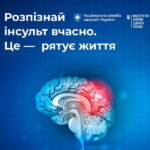 Яка медична допомога гарантована внутрішньо переміщеним особам при інсульті 